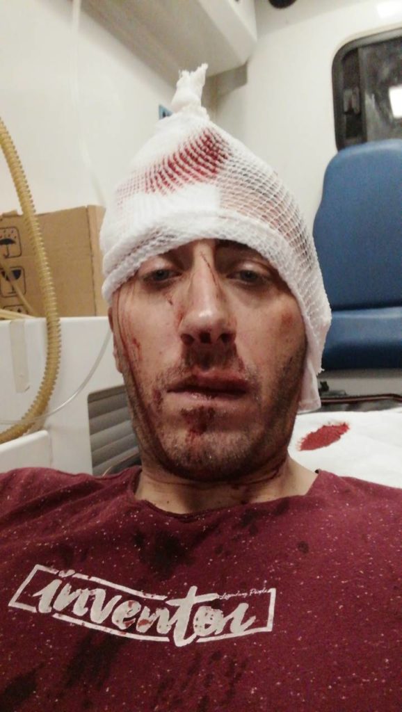 napadači pretukli metalnim šipkama novinara Vladimira Kovačevića