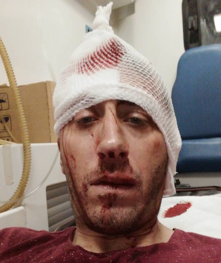 napadači pretukli metalnim šipkama novinara Vladimira Kovačevića